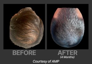 BP_BeforeAfter_DeriveAMP1