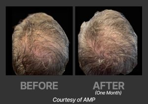 BP_BeforeAfter_DeriveAMP2