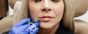 Enhance Your Look with Expert Lip Augmentation